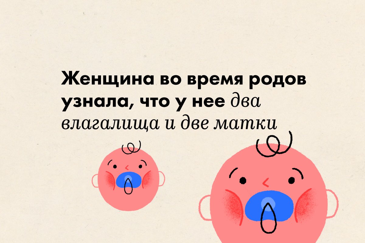 Женщина во время родов узнала, что у нее два влагалища и две матки