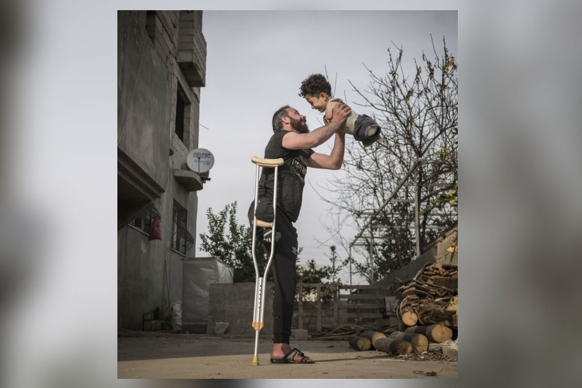 Снимок отца с ребенком без конечностей победил в фотоконкурсе в Сиене - слайд 