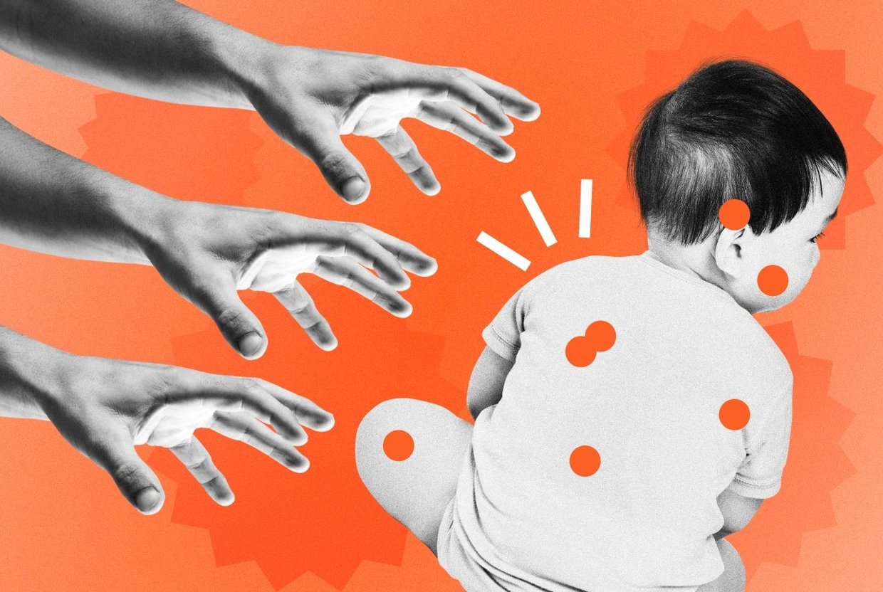 Чесотка у ребенка: симптомы, лечение и профилактика